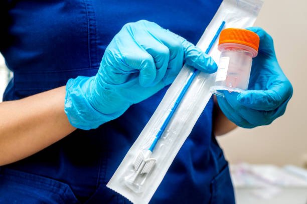 gynecologist holds a brush for sampling liquid cytology gynecologist holds a brush for sampling liquid cytology