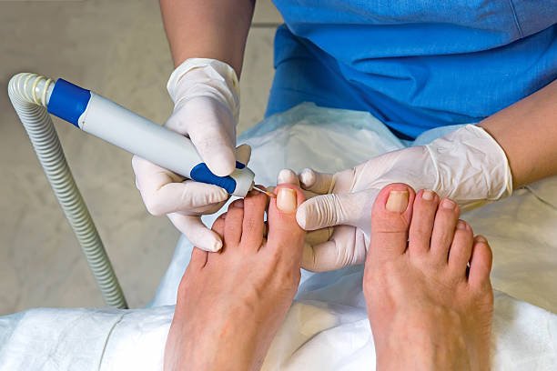 nail operation in hospital nail operation in hospital