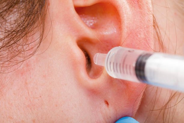 medical ear wash with water in syringe medical ear wash with water in syringe